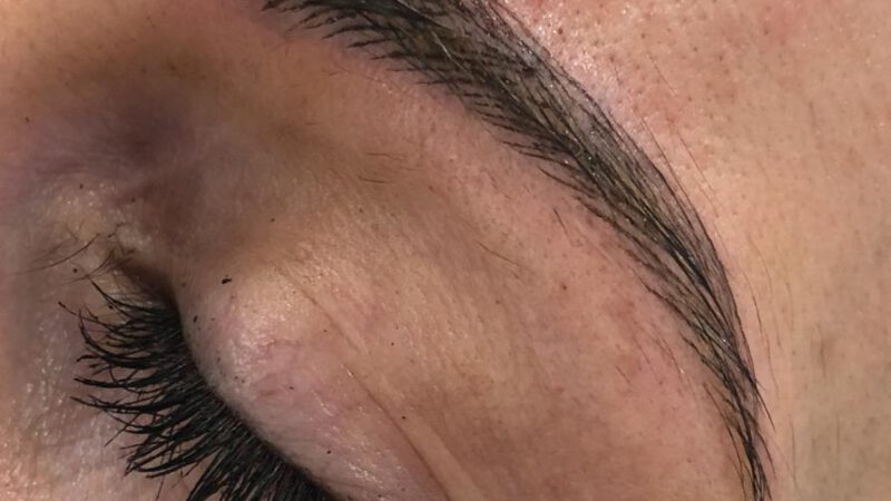 Brow Treatments – Which Brow Treatments Are Right For You?